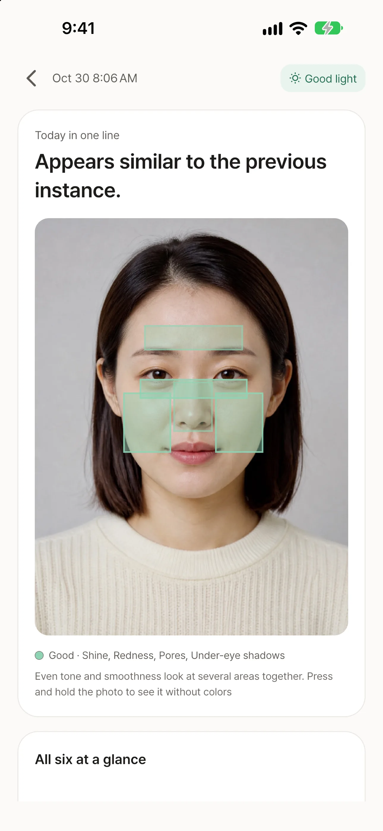SkinDecode 피부 확인 결과 화면 / Skin check result screen